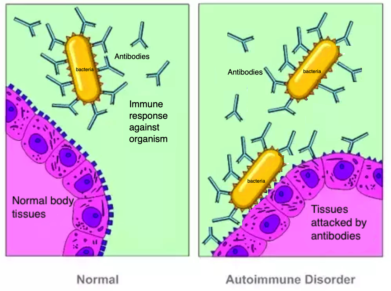 Molecular mimicry in PANS and PANDAS