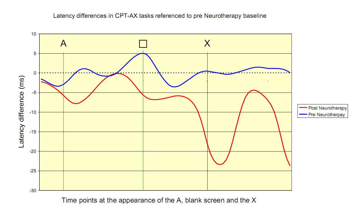 Functional Brain changes following neurotherapy