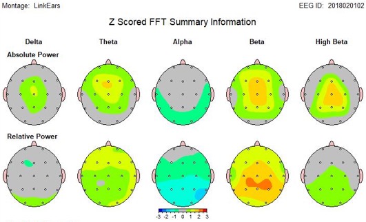 QEEG of TBI patient